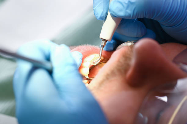 Best Urgent Tooth Repair  in Whitemarsh Island, GA
