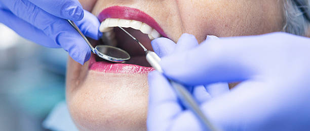 Trusted GA Emergency Dentist Experts